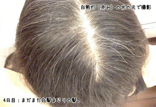 ar髪-アラカミ-白髪用利尻カラーシャンプー使用4日目、全体的に薄茶色に光る白髪が増えてきましたが、まだまだ白髪まじりです。