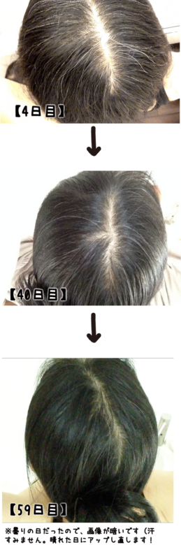 ar髪-アラカミ-利尻カラーシャンプー　4日目と59日目の比較