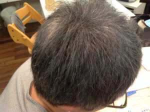 ar髪-アラカミ-白髪の量が多めのショートヘアに白髪用利尻カラーシャンプーを使った場合