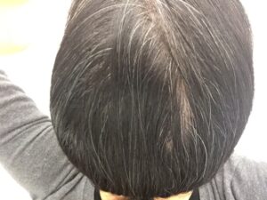 ar髪-アラカミ-白髪用利尻カラーシャンプーの使用をやめて3週間ほどすると白髪も目立ってきます