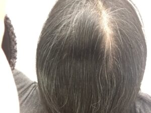ar髪-アラカミ-白髪用利尻カラーシャンプーをやめて3週間ほどの髪