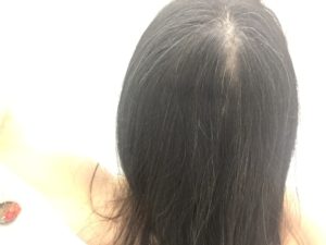 利尻カラーシャンプー2017改良後。使用7日目の髪。まあ白髪は隠れています。