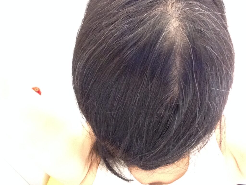 白髪用利尻ヘアカラートリートメントで5分染めした後、1週間が経過した髪(比べてみると、あら、それなりに染まりをキープしていますね)。
